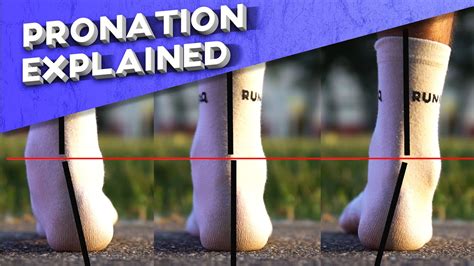 What is overpronation? | Pronation types explained - YouTube