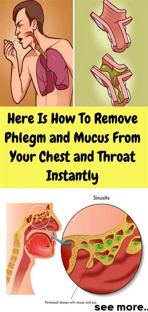 Here Is How To Remove Phlegm and Mucus From Your Chest and Throat ...