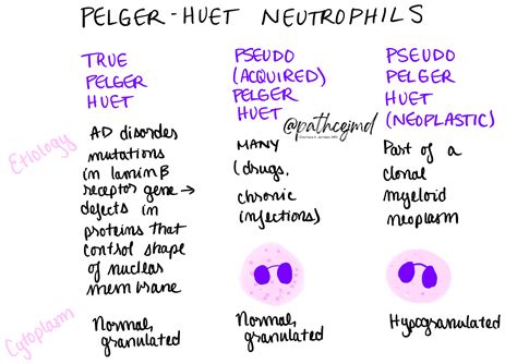 Case 3: Pelger-Huet vs Pseudo-Pelger-Huet Neutrophils Infographic