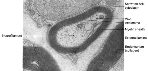 Conduction Velocity and Myelin – Introduction to Sensation and Perception