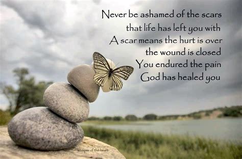 Healing Hands Quotes. QuotesGram