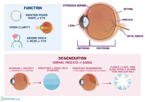 Vitreous Humor: What Is It, Location, Function, Most Important Facts ...