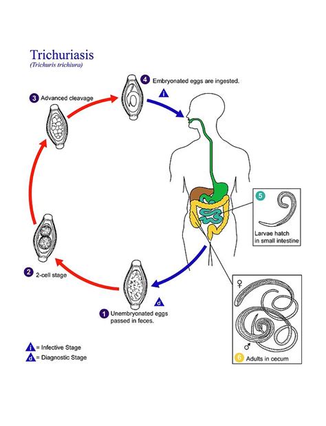 Whipworm Parasite Life Cycle Photograph by Cdc/science Photo Library ...