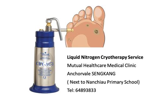 Viral Warts Treatment – Liquid Nitrogen Cryotherapy – Mutual Healthcare