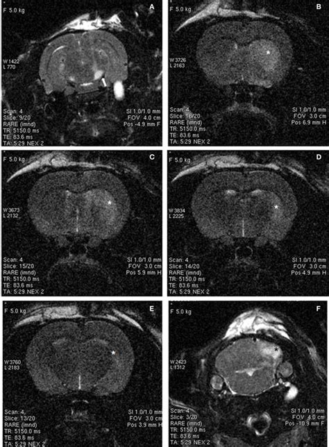 MRI images of rat brain 48 h after ischemia, illustrating coronal ...