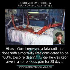 Hisashi Ouchi Radiation Exposure