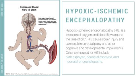 Hypoxic-Ischemic Encephalopathy: Causes and Risk Factors