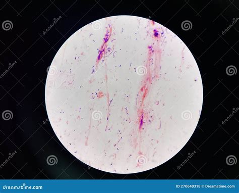 Bacteria Cell in Sputum Sample Gram Stain Method Stock Photo - Image of ...