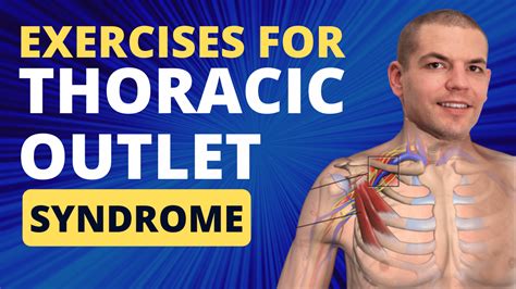 Exercises for Thoracic Outlet Syndrome | Treatment For TOS