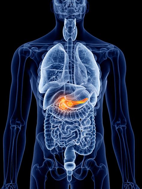 Pancreatitis | MedlinePlus