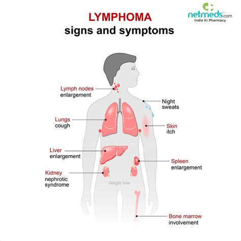 Lymphoma: Causes, Symptoms And Treatment | Netmeds