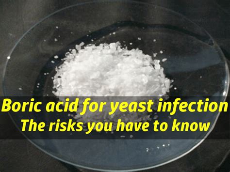 Boric acid for yeast infection: Are boric acid suppositories capsules safe?