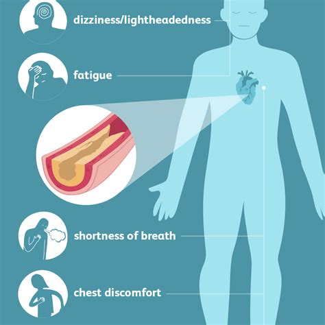 Coronary Artery Disease: Signs, Symptoms, and Complications