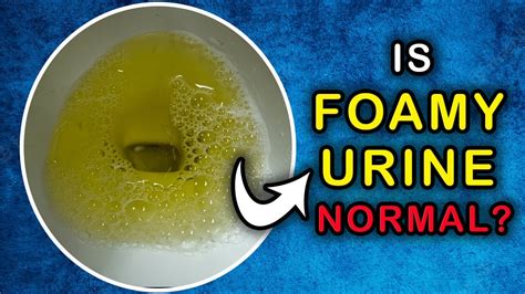 Is it NORMAL to have a FOAMY URINE: Cause and Treatment - YouTube