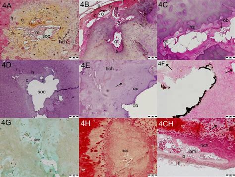 Characteristics of costal cartilages of persons in age more 50 years ...