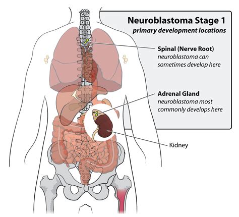 Pediatric Surgery - Pediatric Cancer