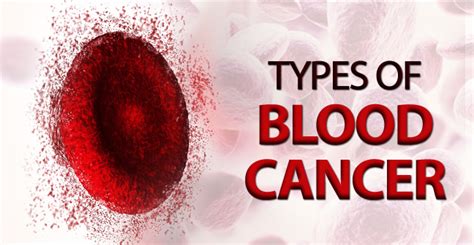 Types of Blood Cancer - Candrol Cancer Treatment & Research Center