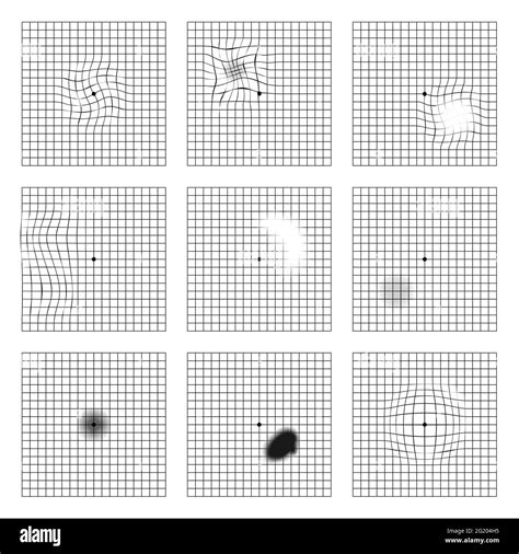 Amsler Grid Chart Printable