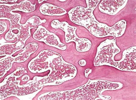 Spongy bone | Histology slides, Bones, Lectures notes
