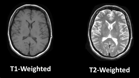 MRtrix Introduction: Overview of Diffusion Imaging — Andy's Brain Book ...