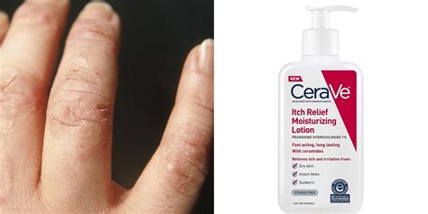 11 Eczema-Friendly Products to Help Prevent Flare-Ups | SELF