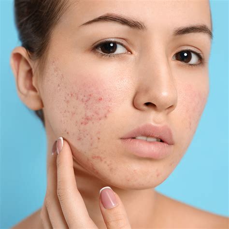 Skin Conditions | Sigma Dermatology