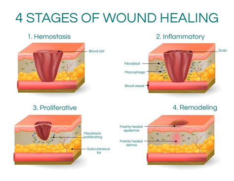 What is poor wound healing?