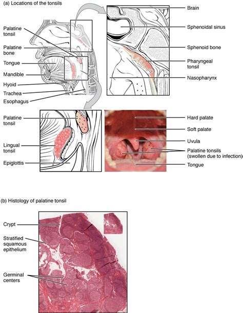 Which Lymphoid Tissues Trap And Remove Bacteria Entering The Throat ...