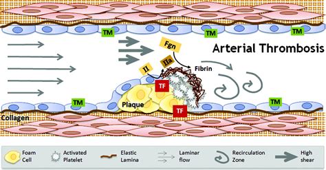 Arterial Thrombosis | Wolberg Lab