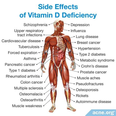 How Can You Get the Right Amount of Vitamin D? - Acne.org