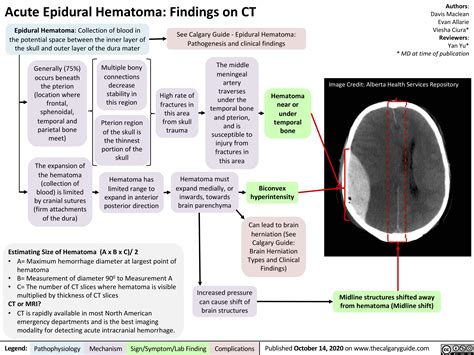 Acute Epidural Hematoma