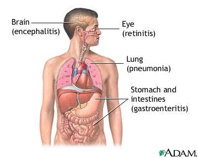 CMV (cytomegalovirus): MedlinePlus Medical Encyclopedia Image