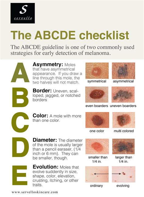 The ABCDE's of Skin Cancer – BU