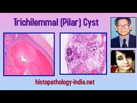 Pin on Pathology Videos