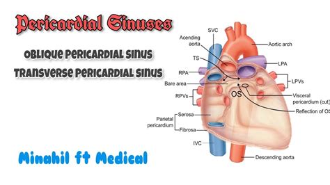 Transverse Pericardial Sinus