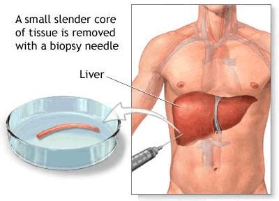 Liver Biopsy | Magnolia Surgery Center