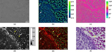 Complementary fluorescence-polarization microscope with... | Download ...