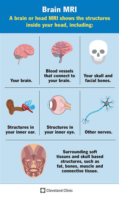 Brain MRI: What It Is, Purpose, Procedure & Results