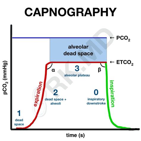 Interpreting Capnograms | RK.MD