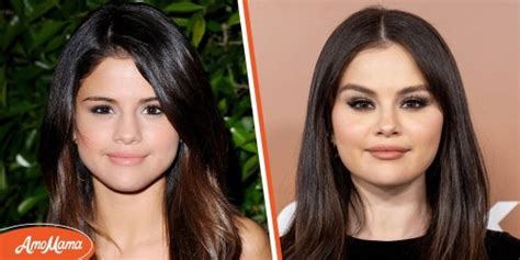 Selena Gomez & Plastic Surgery: Experts Claim She Had Work Done | Flipboard