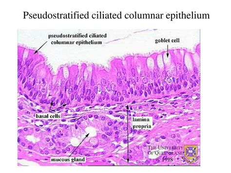 Pseudostratified Ciliated Columnar Epithelium Labeled Diagra