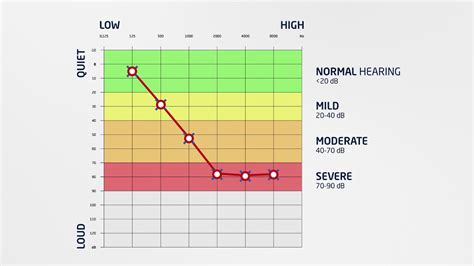 Noise Induced Audiogram