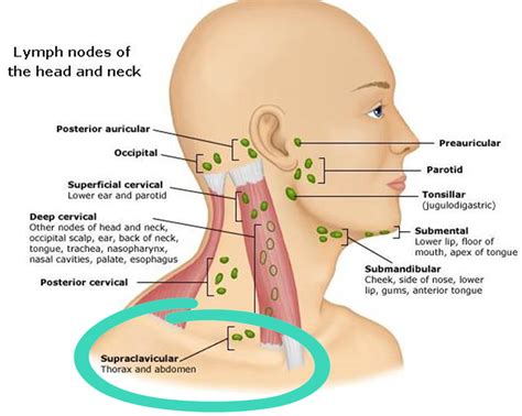 The Bald Bridesmaid: Day 39 | A Cancer Lesson: The Supraclavicular ...