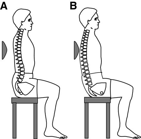 Anterior pelvic tilt exercise: Health Benefits, Correction & How to do?