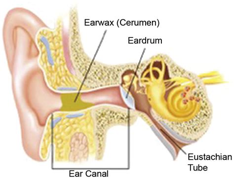 Clinical Practice Guideline (Update): Earwax (Cerumen Impaction ...