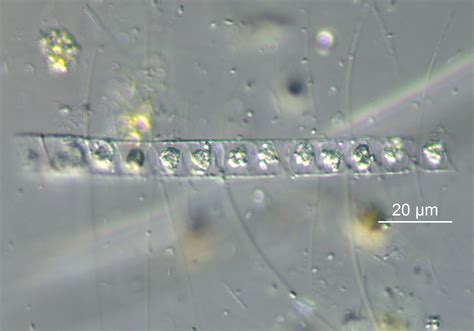 Image Chaetoceros-constrictus-LM2.jpg | Species - Diatoms of North America