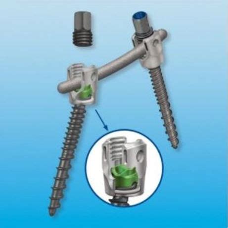 Medtronic Sofamor Danek CD HORIZON SOLERA VOYAGER Pedicle Screw Syst ...