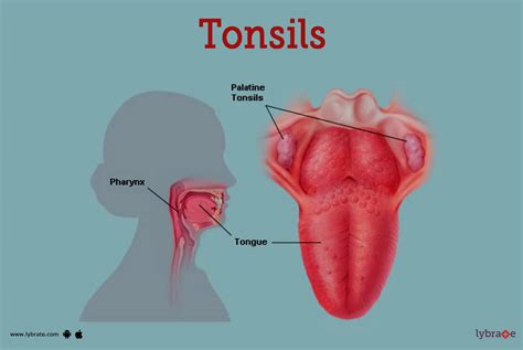 Tonsils (Human Anatomy): Image, Definition, Location, and Problems