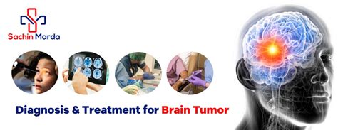 Diagnosis & Treatment for Brain Tumor | Sachin Marda | Best Cancer ...