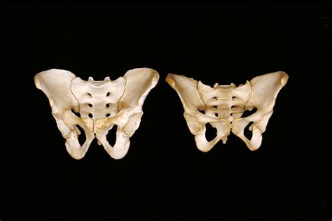 Male and female pelvis | Note the differences in the bony pe… | Flickr